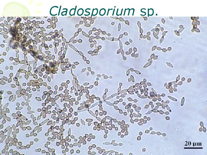 Cladosporium sp. http: //www. mycology. adelaide. edu. au/gallery 