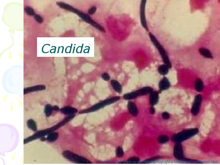 Candida http: //www. bmb. leeds. ac. uk/mbiology/ug/ugteach/icu 8/std/candidgram. html 