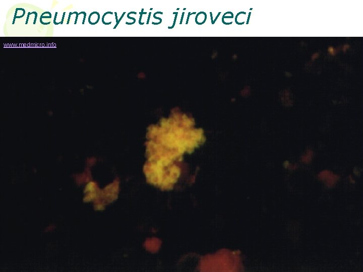 Pneumocystis jiroveci www. medmicro. info 