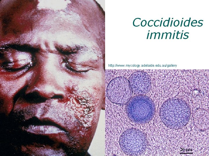 Coccidioides immitis http: //www. mycology. adelaide. edu. au/gallery 