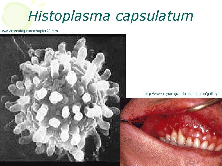 Histoplasma capsulatum www. mycolog. com/chapter 23. htm http: //www. mycology. adelaide. edu. au/gallery 