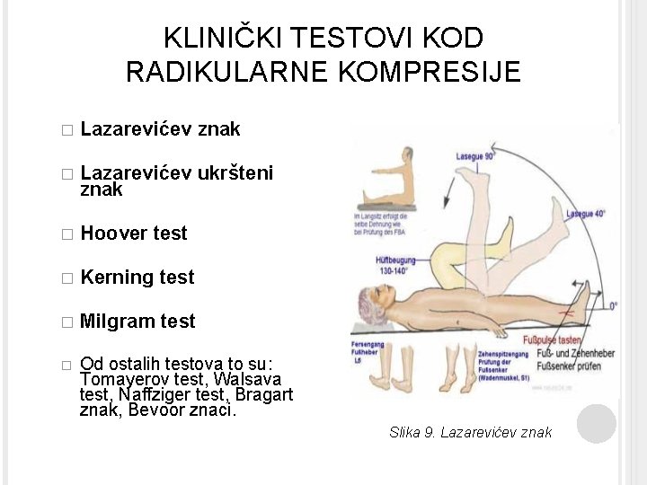 KLINIČKI TESTOVI KOD RADIKULARNE KOMPRESIJE � Lazarevićev znak � Lazarevićev ukršteni znak � Hoover