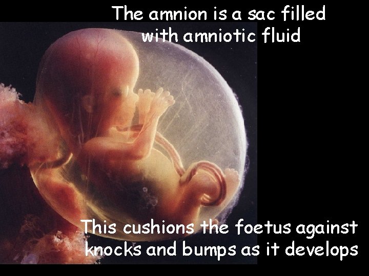 The amnion is a sac filled with amniotic fluid This cushions the foetus against