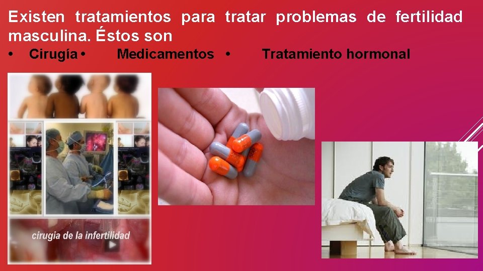 Existen tratamientos para tratar problemas de fertilidad masculina. Éstos son • Cirugía • Medicamentos