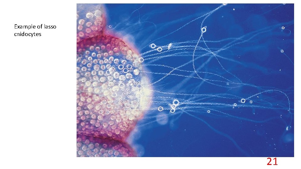 Example of lasso cnidocytes 21 