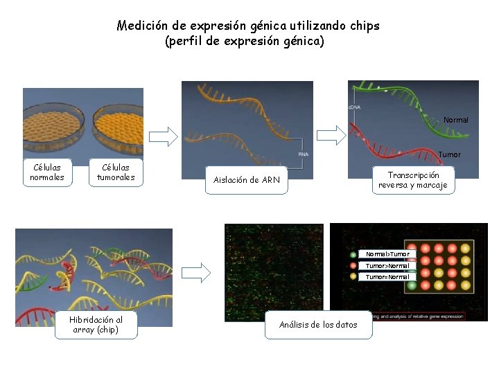 Medición de expresión génica utilizando chips (perfil de expresión génica) Normal Tumor Células normales