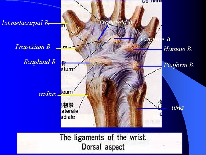 1 st. metacarpal B. Trapezium B. Scaphoid B. Trapezoid B. Capitate B. Hamate B.