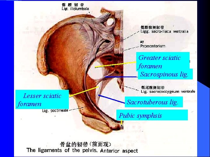 Greater sciatic foramen Sacrospinous lig. Lesser sciatic foramen Sacrotuberous lig. Pubic symphsis 