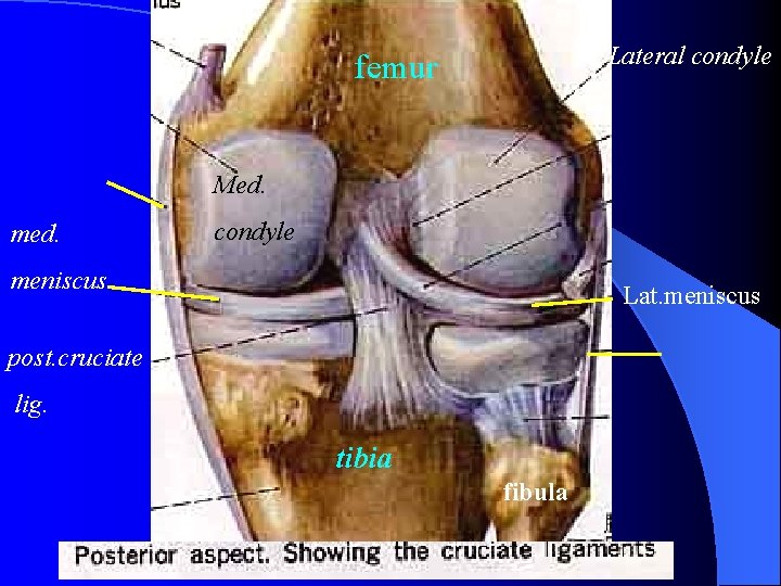 Lateral condyle femur Med. med. condyle meniscus Lat. meniscus post. cruciate lig. tibia fibula