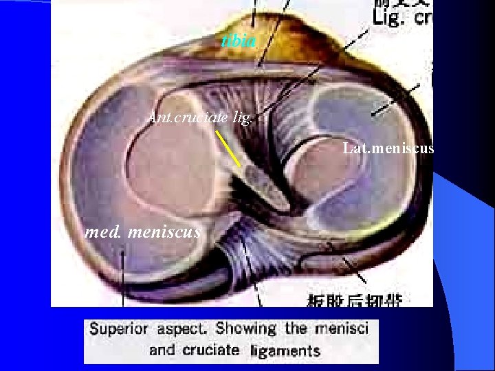 tibia Ant. cruciate lig. Lat. meniscus med. meniscus 