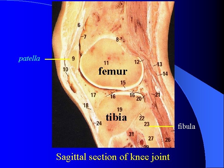 patella femur tibia Sagittal section of knee joint fibula 