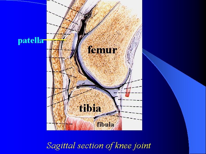 patella femur tibia fibula Sagittal section of knee joint 