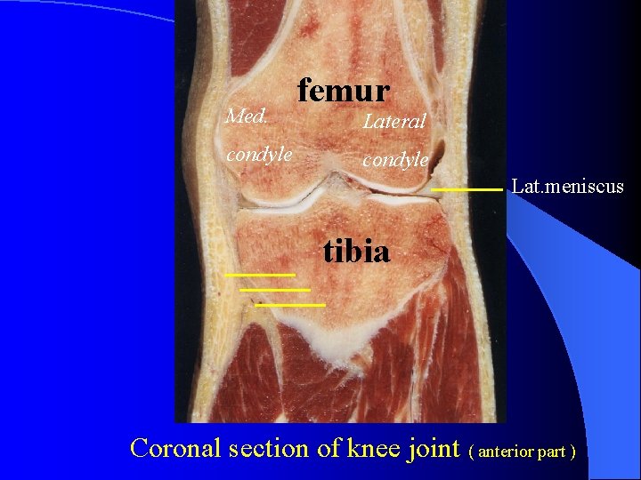 Med. condyle femur Lateral condyle Lat. meniscus tibia Coronal section of knee joint (