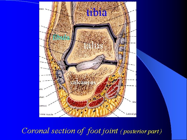 tibia fibula talus calcaneus Coronal section of foot joint ( posterior part ) 