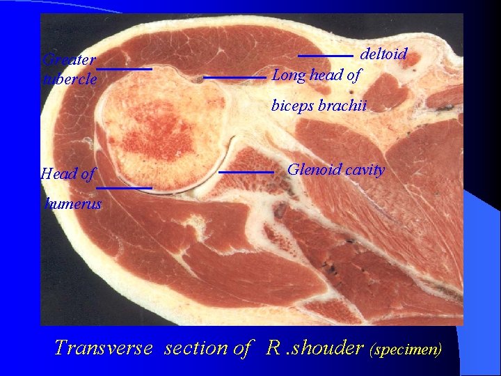 Greater tubercle deltoid Long head of biceps brachii Head of Glenoid cavity humerus Transverse
