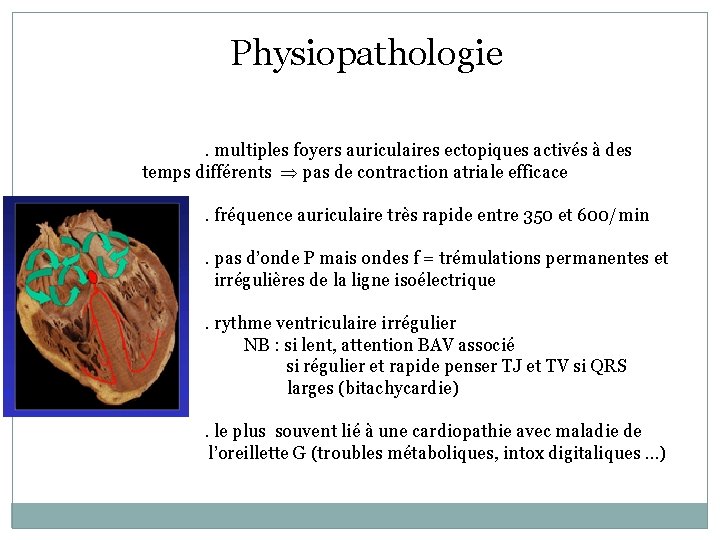 Physiopathologie. multiples foyers auriculaires ectopiques activés à des temps différents pas de contraction atriale