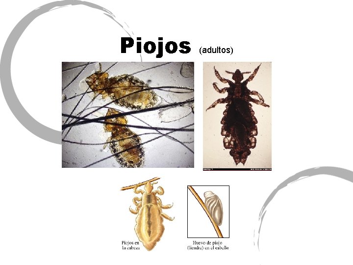 Piojos (adultos) 