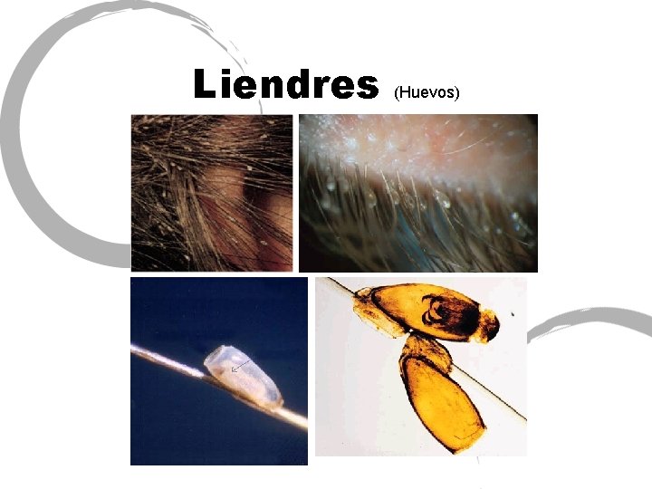 Liendres (Huevos) 