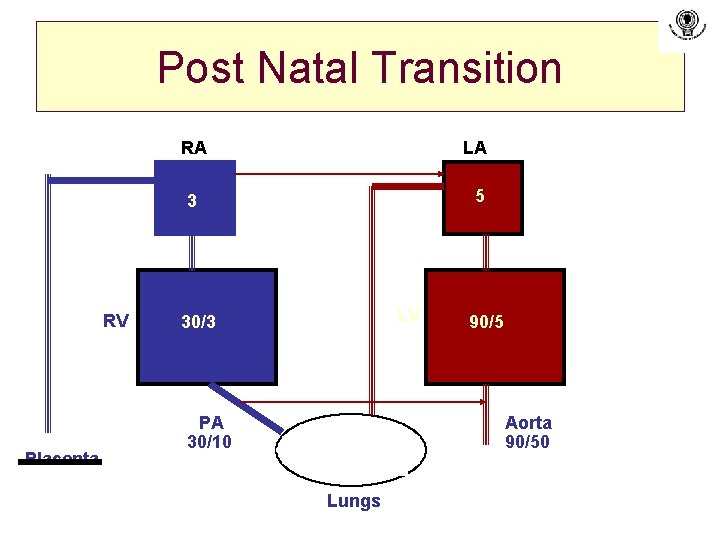 Post Natal Transition RV Placenta RA LA 3 5 LV 30/3 PA 30/10 90/5