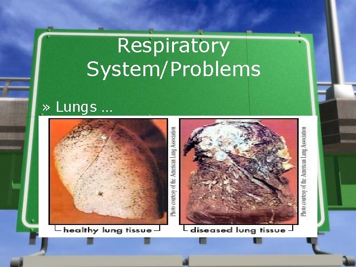 Respiratory System/Problems » Lungs … 