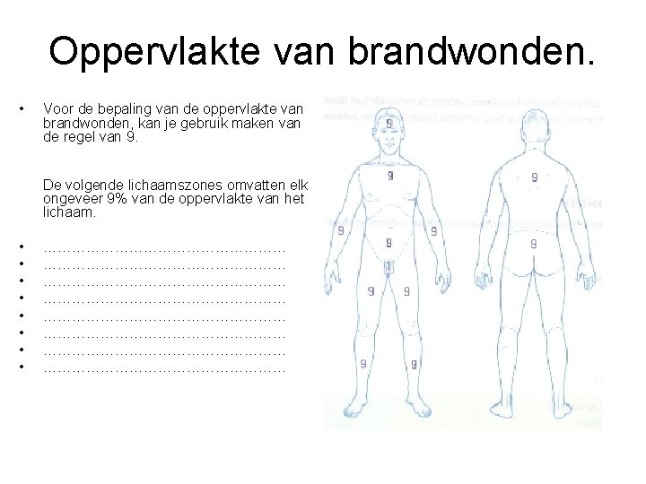 Oppervlakte van brandwonden. • Voor de bepaling van de oppervlakte van brandwonden, kan je