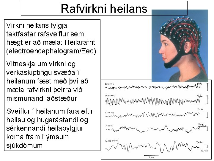 Rafvirkni heilans Virkni heilans fylgja taktfastar rafsveiflur sem hægt er að mæla: Heilarafrit (electroencephalogram/Eec)