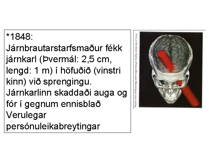 *1848: Járnbrautarstarfsmaður fékk járnkarl (Þvermál: 2, 5 cm, lengd: 1 m) í höfuðið (vinstri