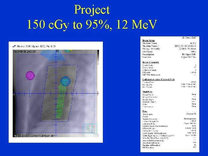 Project 150 c. Gy to 95%, 12 Me. V 