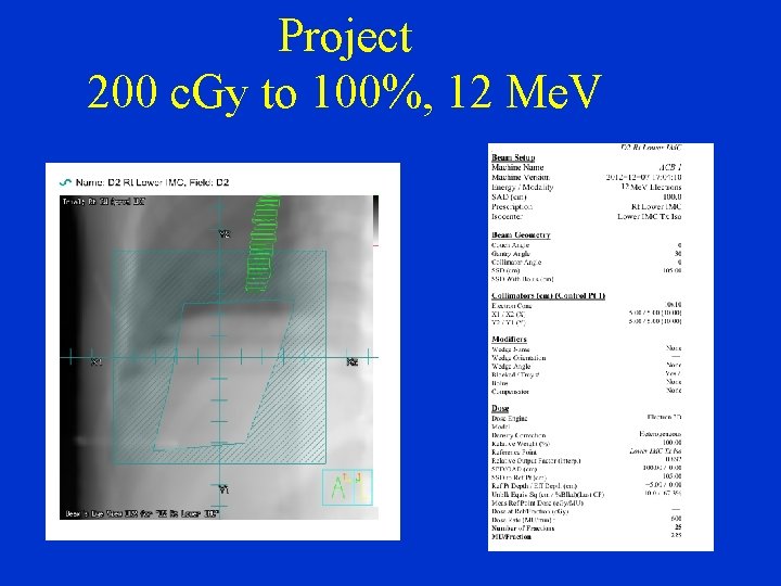 Project 200 c. Gy to 100%, 12 Me. V 