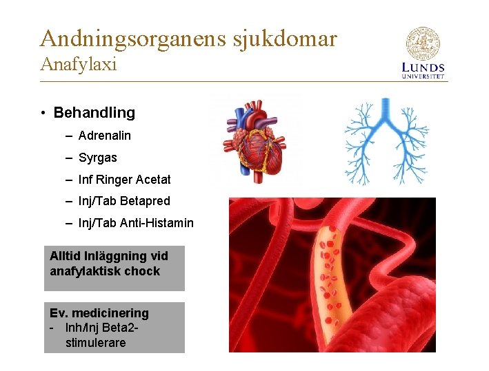 Andningsorganens sjukdomar Anafylaxi • Behandling – Adrenalin – Syrgas – Inf Ringer Acetat –