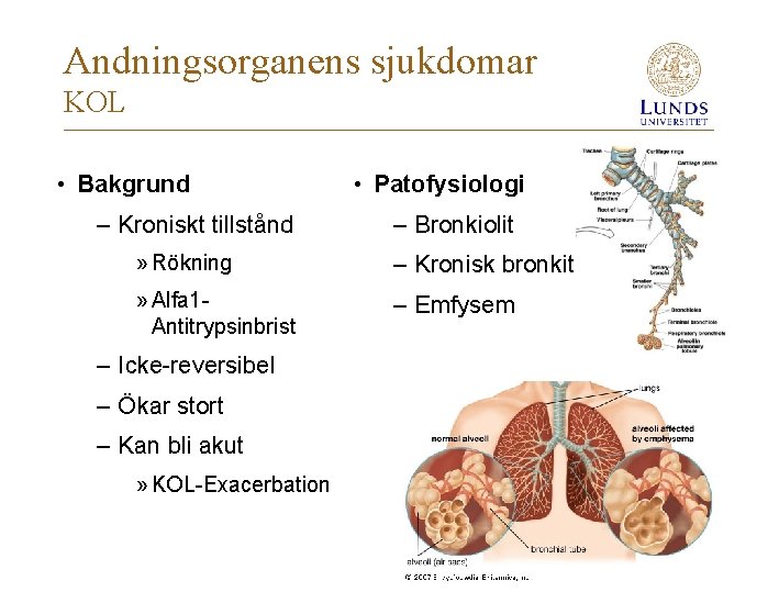 Andningsorganens sjukdomar KOL • Bakgrund – Kroniskt tillstånd • Patofysiologi – Bronkiolit » Rökning