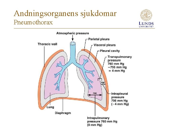 Andningsorganens sjukdomar Pneumothorax 