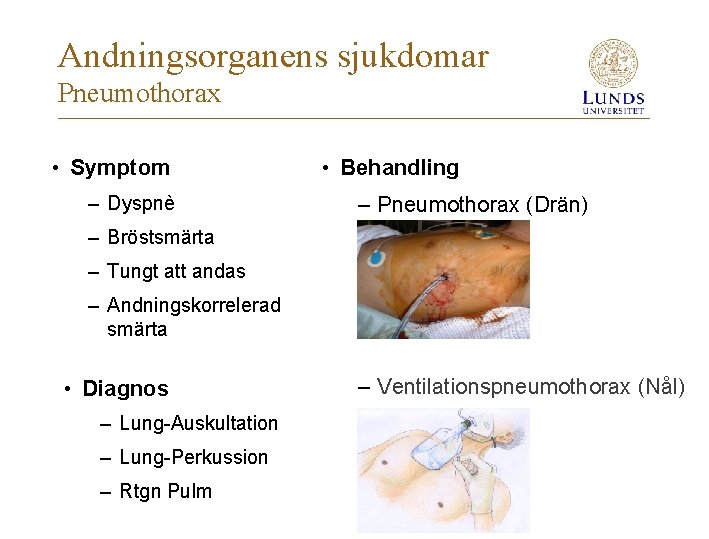 Andningsorganens sjukdomar Pneumothorax • Symptom – Dyspnè • Behandling – Pneumothorax (Drän) – Bröstsmärta