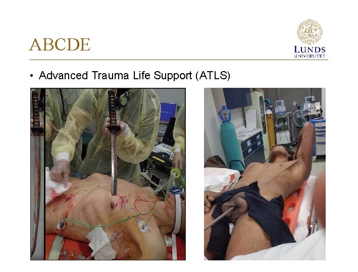 ABCDE • Advanced Trauma Life Support (ATLS) 