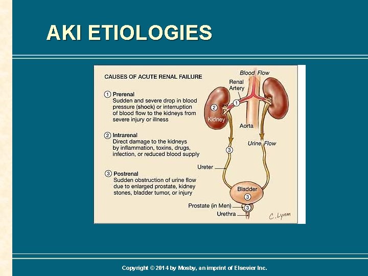 AKI ETIOLOGIES Copyright © 2014 by Mosby, an imprint of Elsevier Inc. 