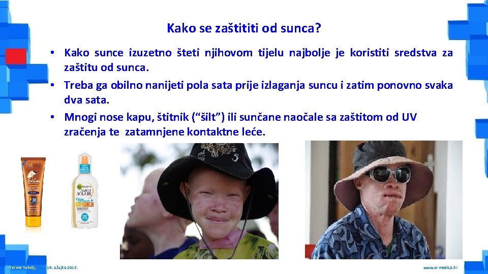 Kako se zaštititi od sunca? • Kako sunce izuzetno šteti njihovom tijelu najbolje je