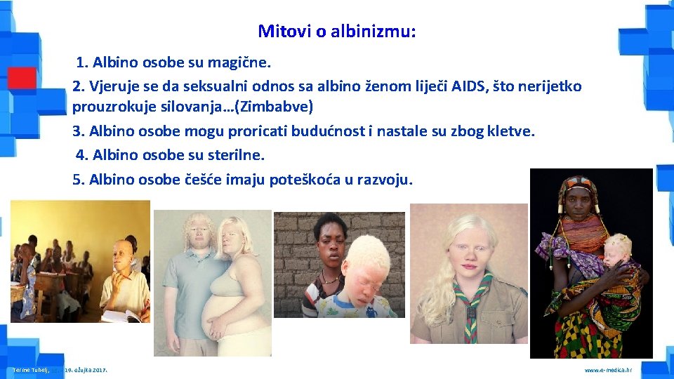 Mitovi o albinizmu: 1. Albino osobe su magične. 2. Vjeruje se da seksualni odnos