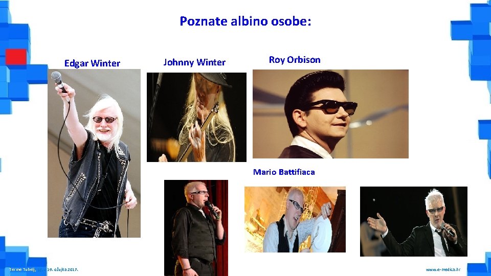 Poznate albino osobe: Edgar Winter Johnny Winter Roy Orbison Mario Battifiaca Terme Tuhelj, 16.