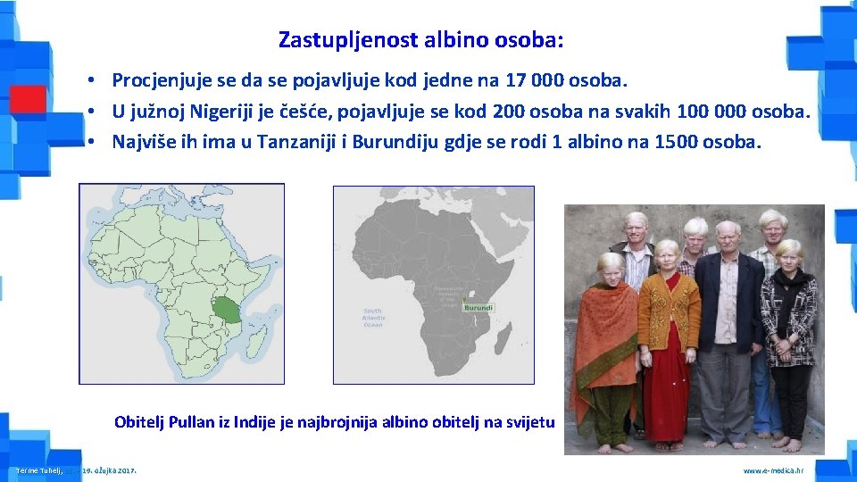 Zastupljenost albino osoba: • Procjenjuje se da se pojavljuje kod jedne na 17 000