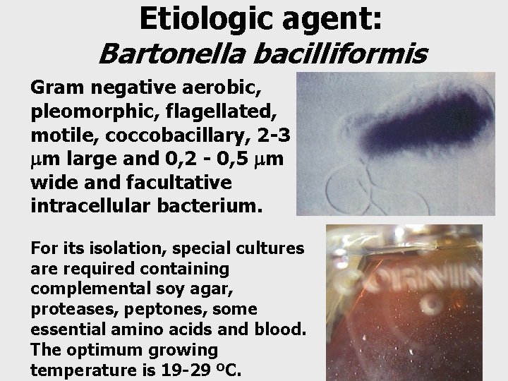 Etiologic agent: Bartonella bacilliformis Gram negative aerobic, pleomorphic, flagellated, motile, coccobacillary, 2 -3 m