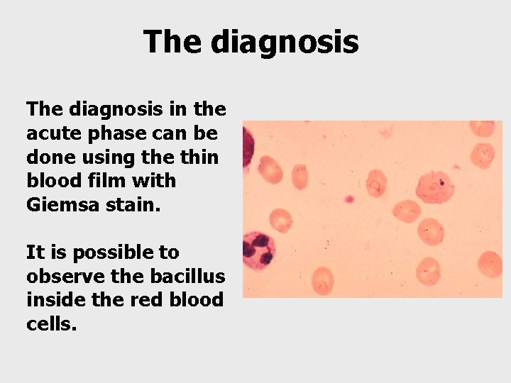 The diagnosis in the acute phase can be done using the thin blood film