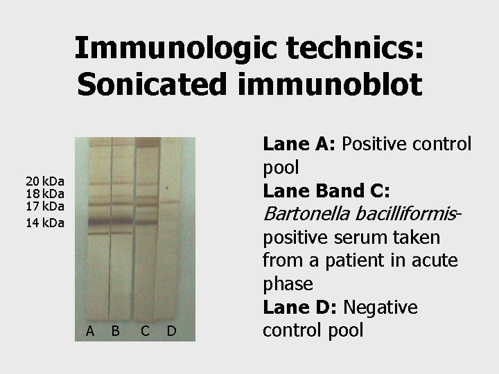 Immunologic technics: Sonicated immunoblot 20 18 17 14 k. Da A B C D