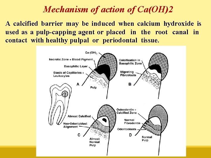 Mechanism of action of Ca(OH)2 A calcified barrier may be induced when calcium hydroxide