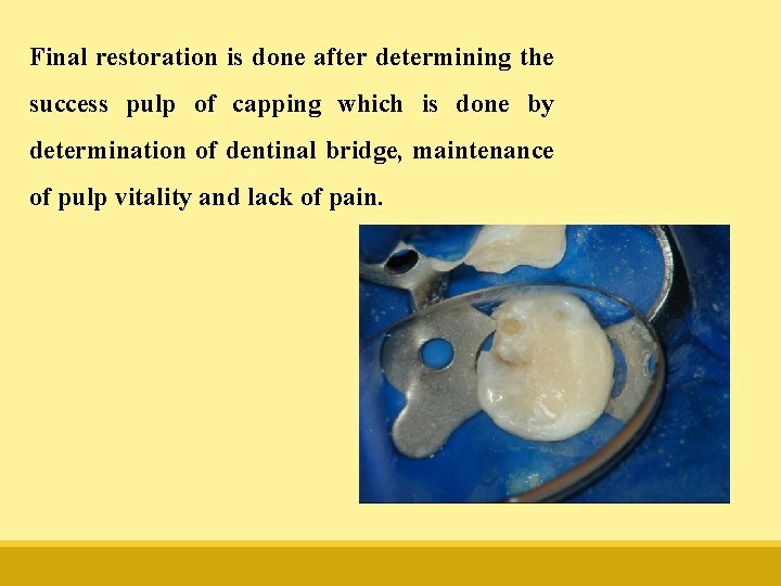 Final restoration is done after determining the success pulp of capping which is done