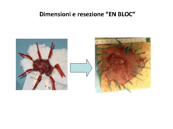 Dimensioni e resezione “EN BLOC” 