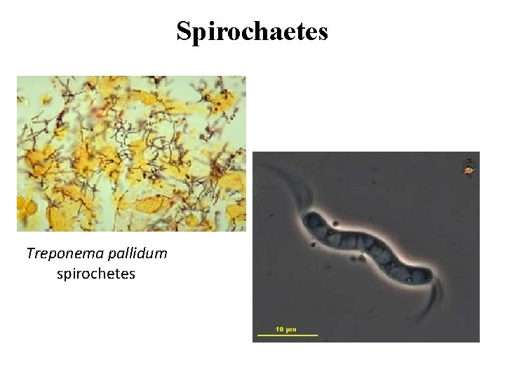 Spirochaetes Treponema pallidum spirochetes 