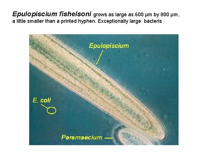 Epulopiscium fishelsoni grows as large as 600 µm by 800 µm, a little smaller