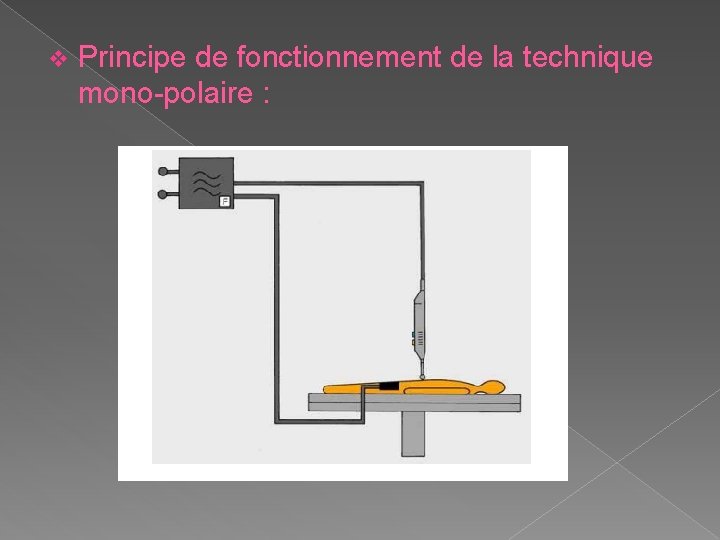 v Principe de fonctionnement de la technique mono-polaire : 