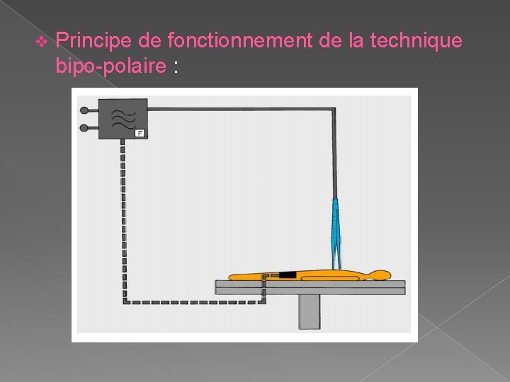 v Principe de fonctionnement de la technique bipo-polaire : 