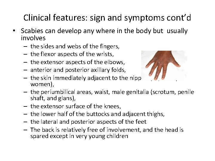 Clinical features: sign and symptoms cont’d • Scabies can develop any where in the